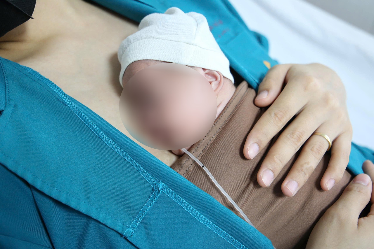 Em b&eacute; được ra gh&eacute;p mẹ, thực hiện phương ph&aacute;p Kangaroo. Ảnh: BVCC