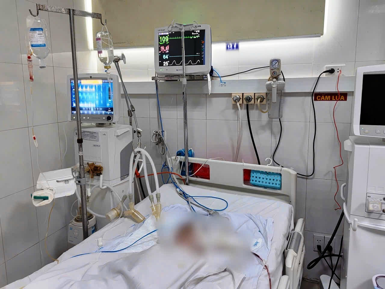 C&oacute; 3 trường hợp chấn thương nặng, trong đ&oacute; c&oacute; 1 bệnh nh&acirc;n mới 11 th&aacute;ng tuổi.