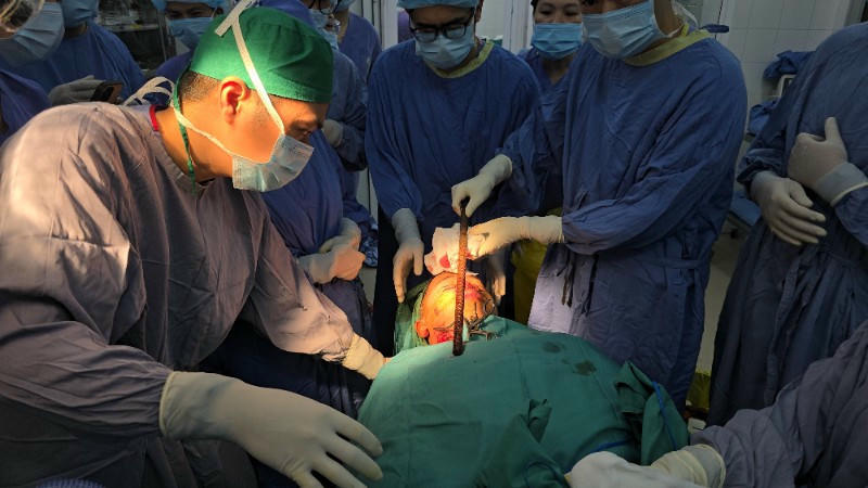 Ca phẫu thuật c&oacute; sự phối hợp li&ecirc;n khoa.