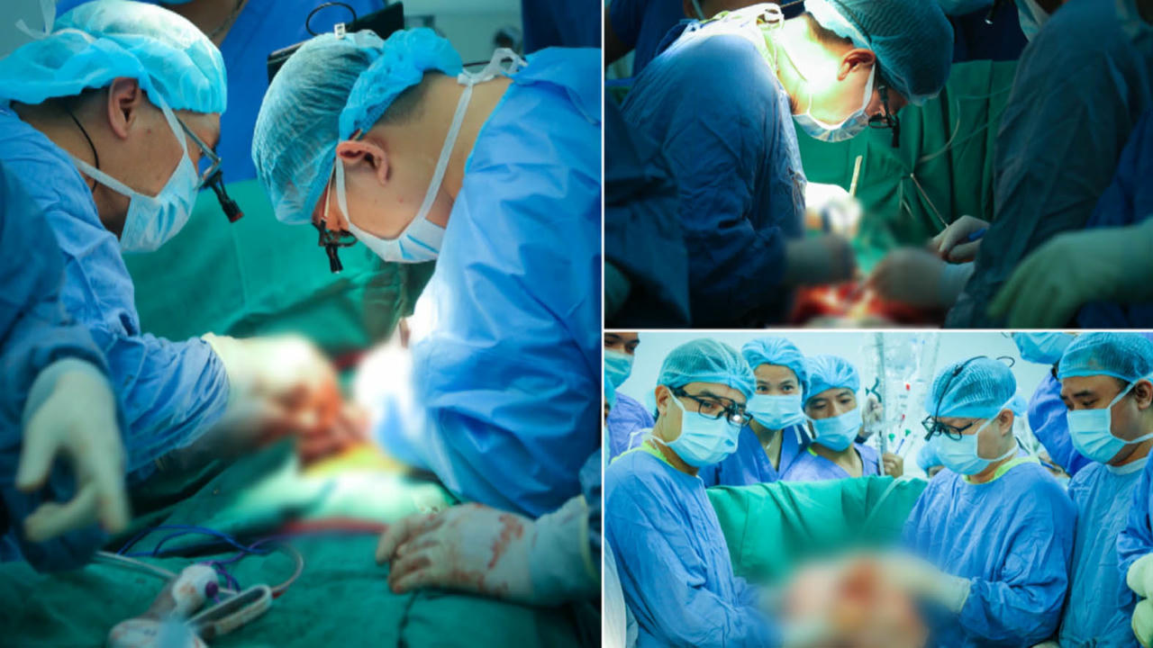 Ca gh&eacute;p đồng thời tim - phổi đầu ti&ecirc;n tại Việt Nam.  (Nguồn: BV Hữu nghị Việt Đức)