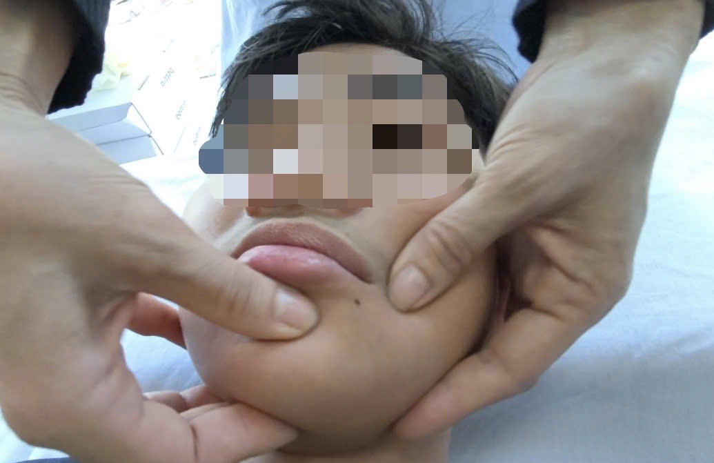 Đang khỏe mạnh, bỗng méo miệng vì lạnh