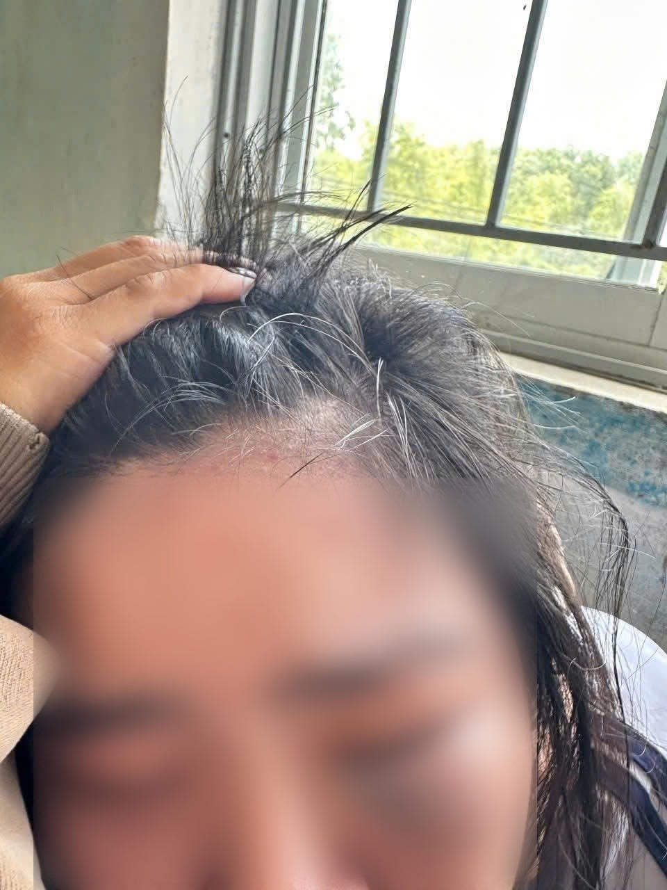 &nbsp;Gia đ&igrave;nh đưa ch&aacute;u D đến Bệnh viện Trung ương Quảng Nam (TP. Đ&agrave; Nẵng) để kiểm tra, điều trị.