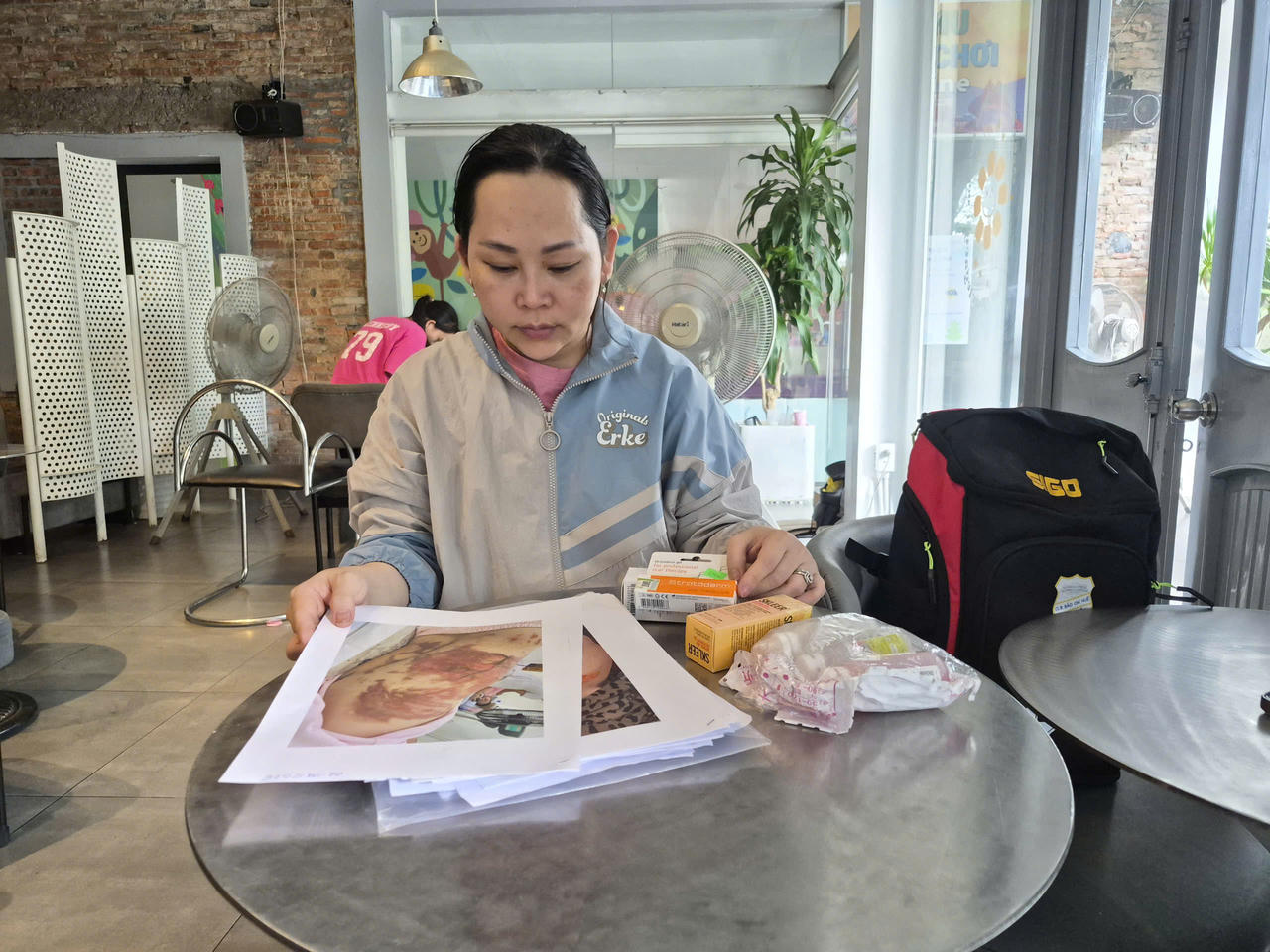 Sau sự cố bỏng phải điều trị k&eacute;o d&agrave;i, kế hoạch trở về nước của người phụ nữ bị ảnh hưởng.