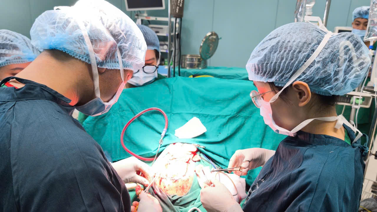 C&aacute;c b&aacute;c sĩ tiến h&agrave;nh phẫu thuật cho bệnh nh&acirc;n. Ảnh: Thanh Thanh
