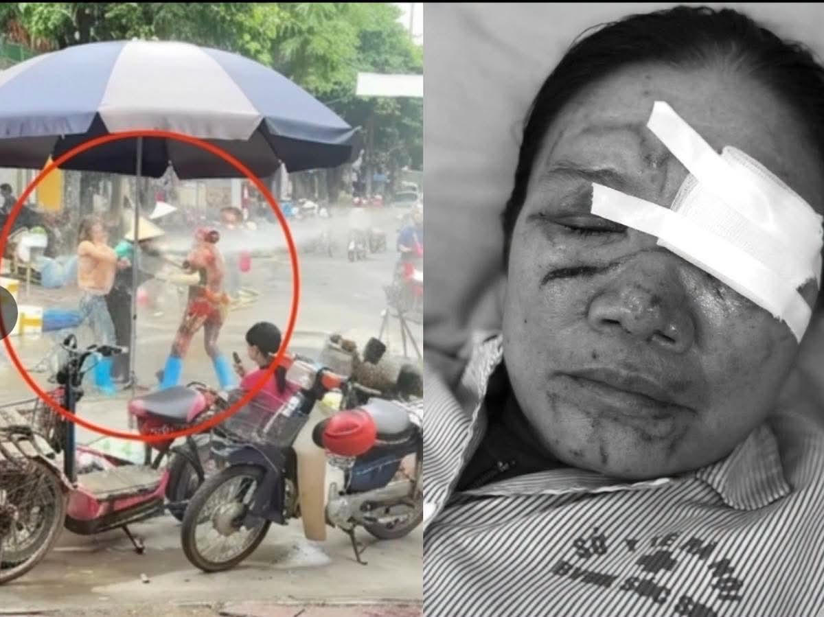 B&agrave; b&aacute;n c&aacute; xịt nước cao &aacute;p khiến b&agrave; b&aacute;n rau bị thương. (Ảnh: CACC)&nbsp;