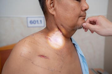 Vết thương người bệnh sau 3 tuần xuất viện, trước t&aacute;i kh&aacute;m