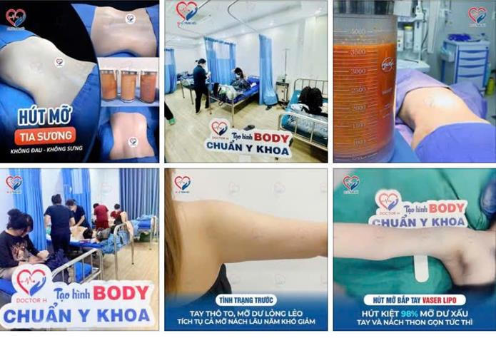 Một số nội dung quảng c&aacute;o dịch vụ thẩm mỹ của cơ sở Julia Aesthetic được đăng tải tr&ecirc;n mạng x&atilde; hội.