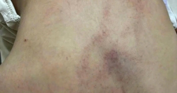 Khẩn trương xác minh việc trẻ mầm non nghi bị giáo viên bạo hành ở Hà Nội