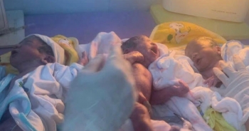 Lần đầu tiên Bệnh viện Tuyên Hóa mổ thành công ca sinh 3 tự nhiên hiếm gặp