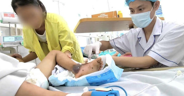 Đắp thuốc nam chữa vết mèo cào, bé trai 4 tuổi bị suy đa tạng