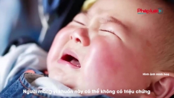 Thanh thiếu niên và trẻ nhỏ mắc não mô cầu có tỉ lệ tử vong lên đến 15% hoặc để lại di chứng suốt đời